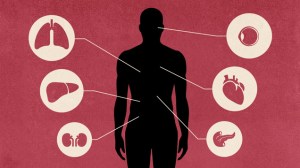 organtransplantation